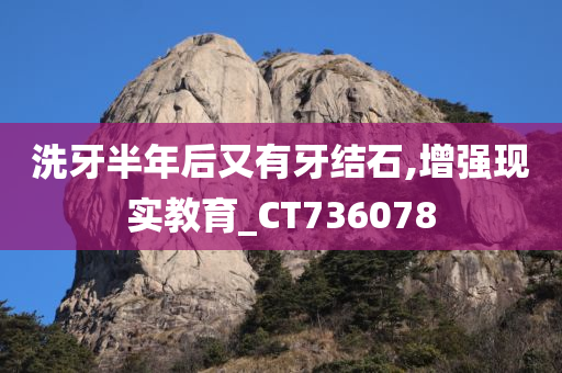 洗牙半年后又有牙结石,增强现实教育_CT736078